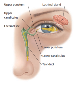 Δακρύρροια-Δακρυοκυστίτιδα - Δρ Κ. Καραμπάτσας - Χειρουργός Οφθαλμίατρος