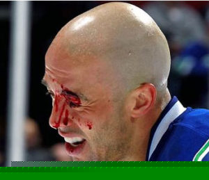 Σπόρ και οφθαλμικοί τραυματισμοί - Δρ Κ. Καραμπάτσας - Χειρουργός Οφθαλμίατρος