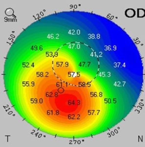 Κωνσταντίνος Καραμπάτσας Χειρούργος οφθαλμίατρος