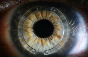 Κωνσταντίνος Καραμπάτσας Χειρούργος οφθαλμίατρος