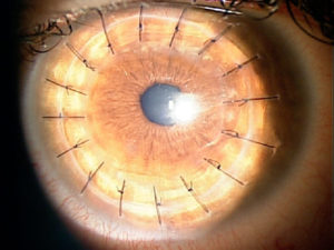 Κωνσταντίνος Καραμπάτσας Χειρούργος οφθαλμίατρος