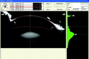 Κωνσταντίνος Καραμπάτσας Χειρούργος οφθαλμίατρος
