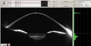 Κωνσταντίνος Καραμπάτσας Χειρούργος οφθαλμίατρος