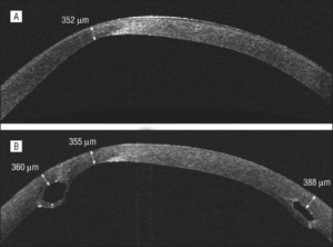 Κωνσταντίνος Καραμπάτσας Χειρούργος οφθαλμίατρος