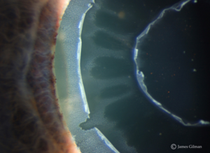 Κωνσταντίνος Καραμπάτσας Χειρούργος οφθαλμίατρος