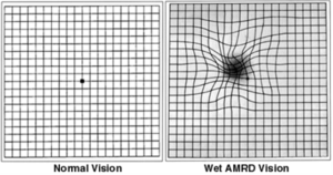 Amsler recording chart