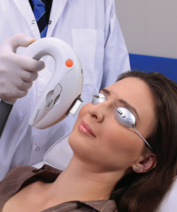 IPL laser θεραπεία